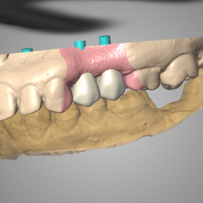 PS DENTAL