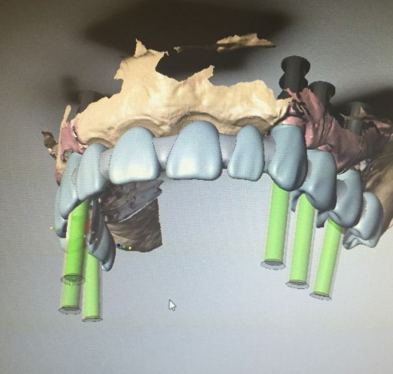 Diseño CAD