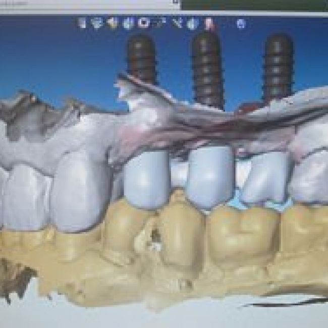 Diseño Cad Cam