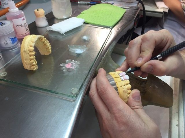 Trabajo sobre molde de dentadura