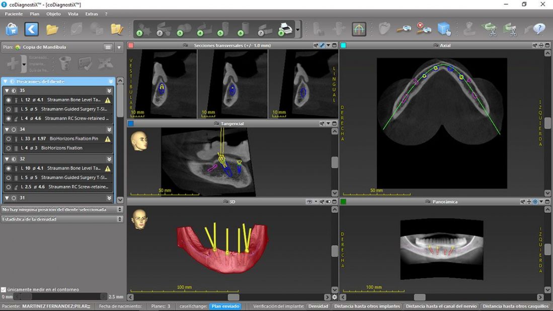 Cirugía Guiada Codiagnostix