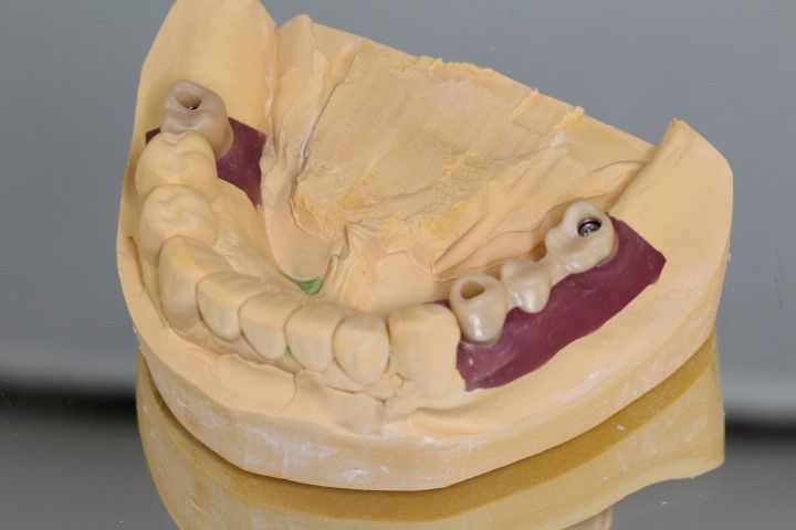 Estructura de circonio sobre Vario Base