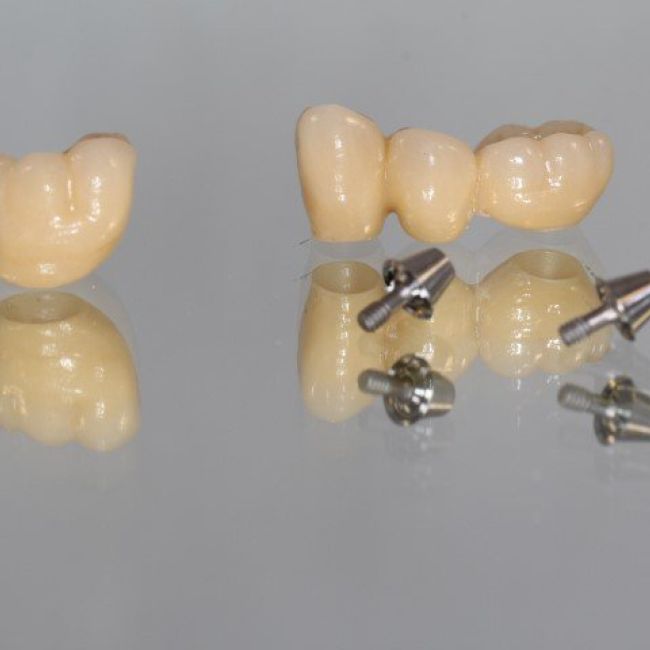 big 140110 144883 Puente Variobase Straunann