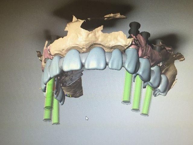 Diseño CAD