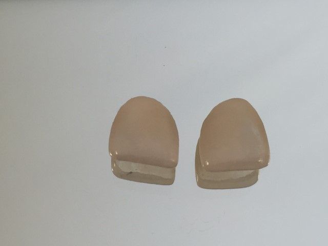 Microcarillas dentales finalizadas