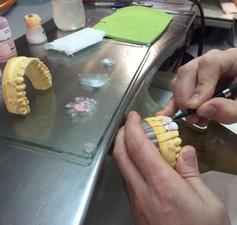 Trabajo sobre molde de dentadura