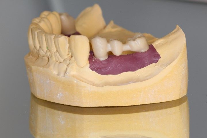 Estructura de circonio sobre Vario Base