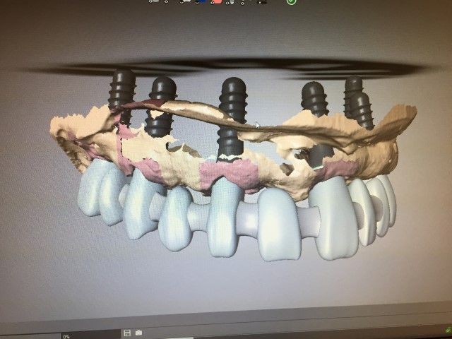 Diseño CAD