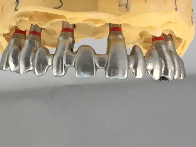 Estructura metálica fresada