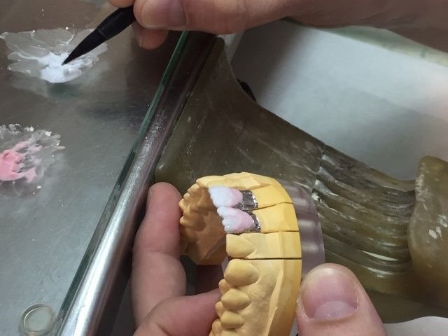 Pigmentación para microcarillas