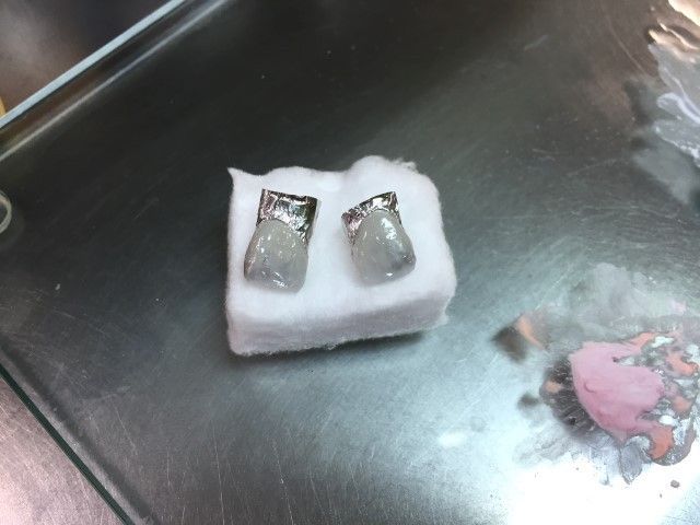 Ajuste de oclusión sobre microcarillas