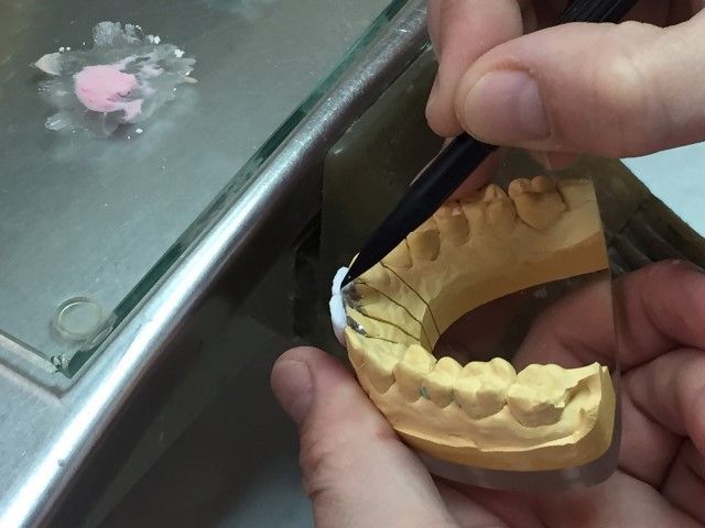 Trabajo sobre microcarillas de porcelana