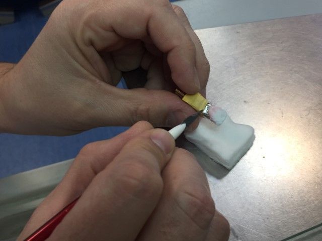 Ajustes finales de microcarilla