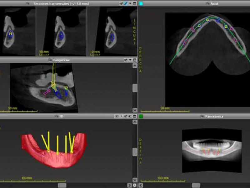 contamos con softwares de última generación
