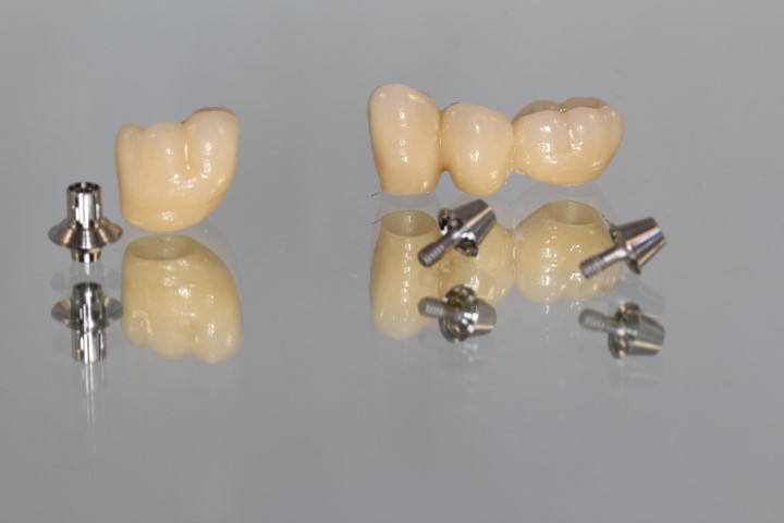 Implantes dentales Straumann